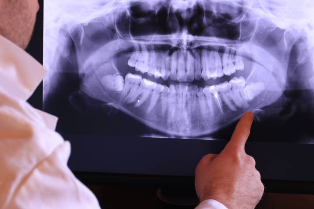 Best Emergency Dental Extractions in Harper, KS